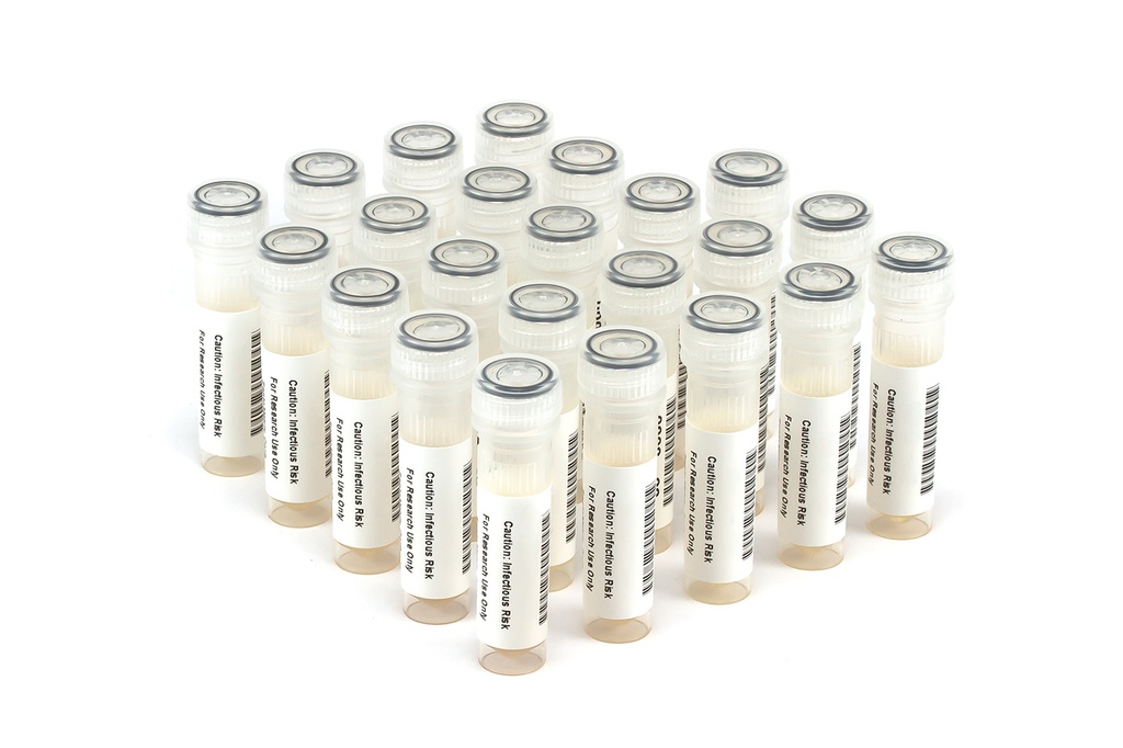 HBV11009 HBV Seroconversion Panel Donor n. 67449 (23x 1 ml)