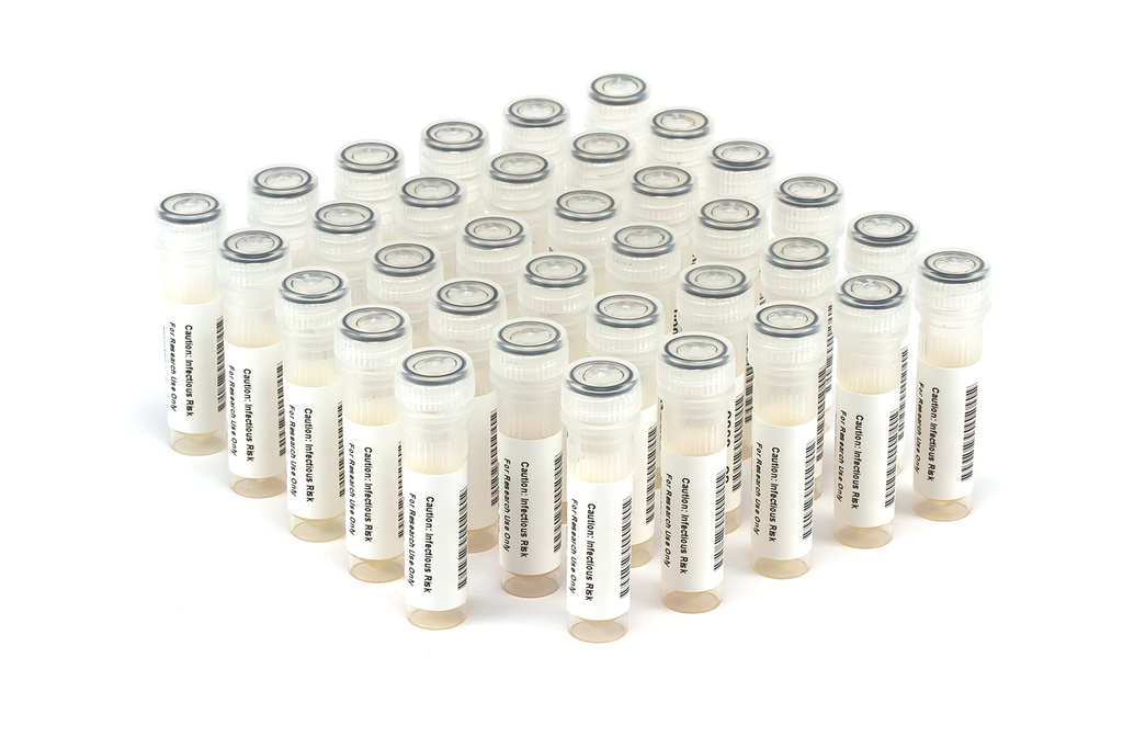 HBV11013 HBV Seroconversion Panel Donor n. 67962 (35x 1 ml)