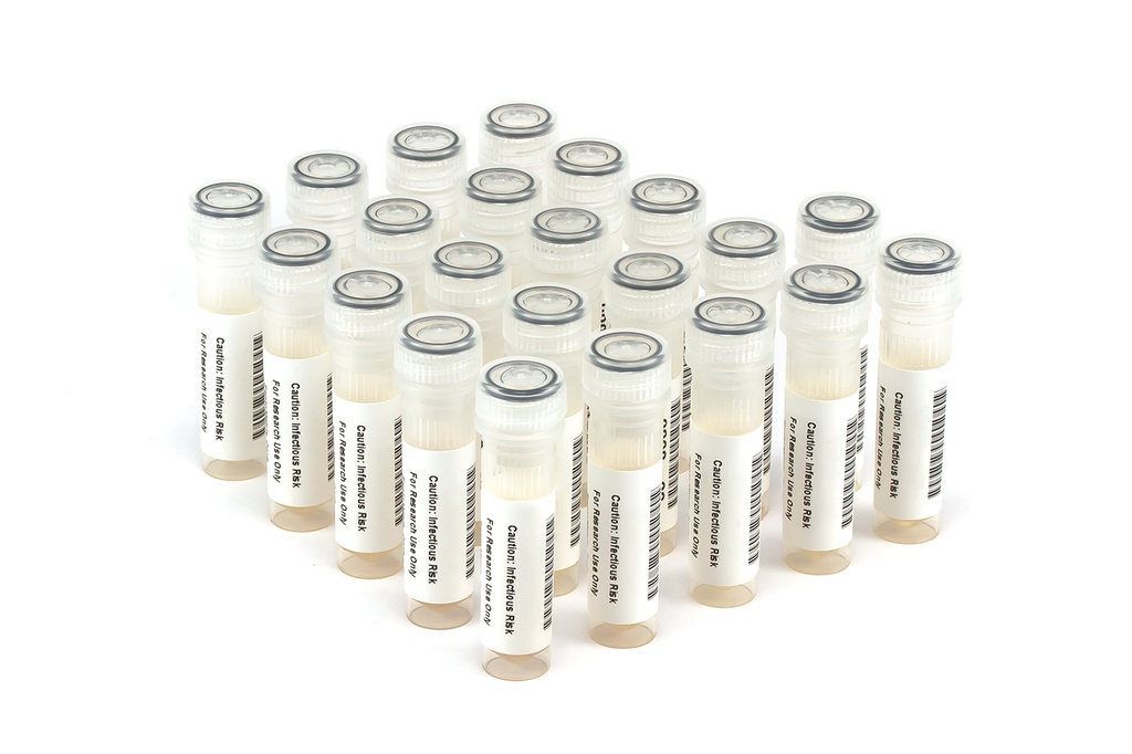 HIV9020 HIV Seroconversion Panel Donor n. 67512 (22x 1 ml)